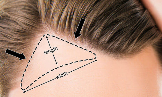 Men's Hair Temples